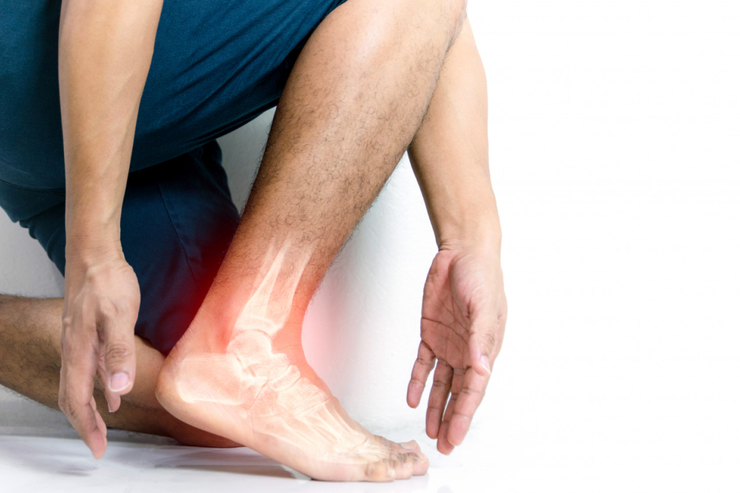 Is Heel Pain Caused by Heel Spurs or Plantar Fasciitis? | Sports-health